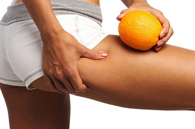 Cellulite Is Way More Common Than You Think